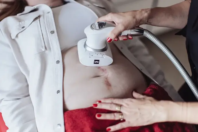 traitement cicatrices